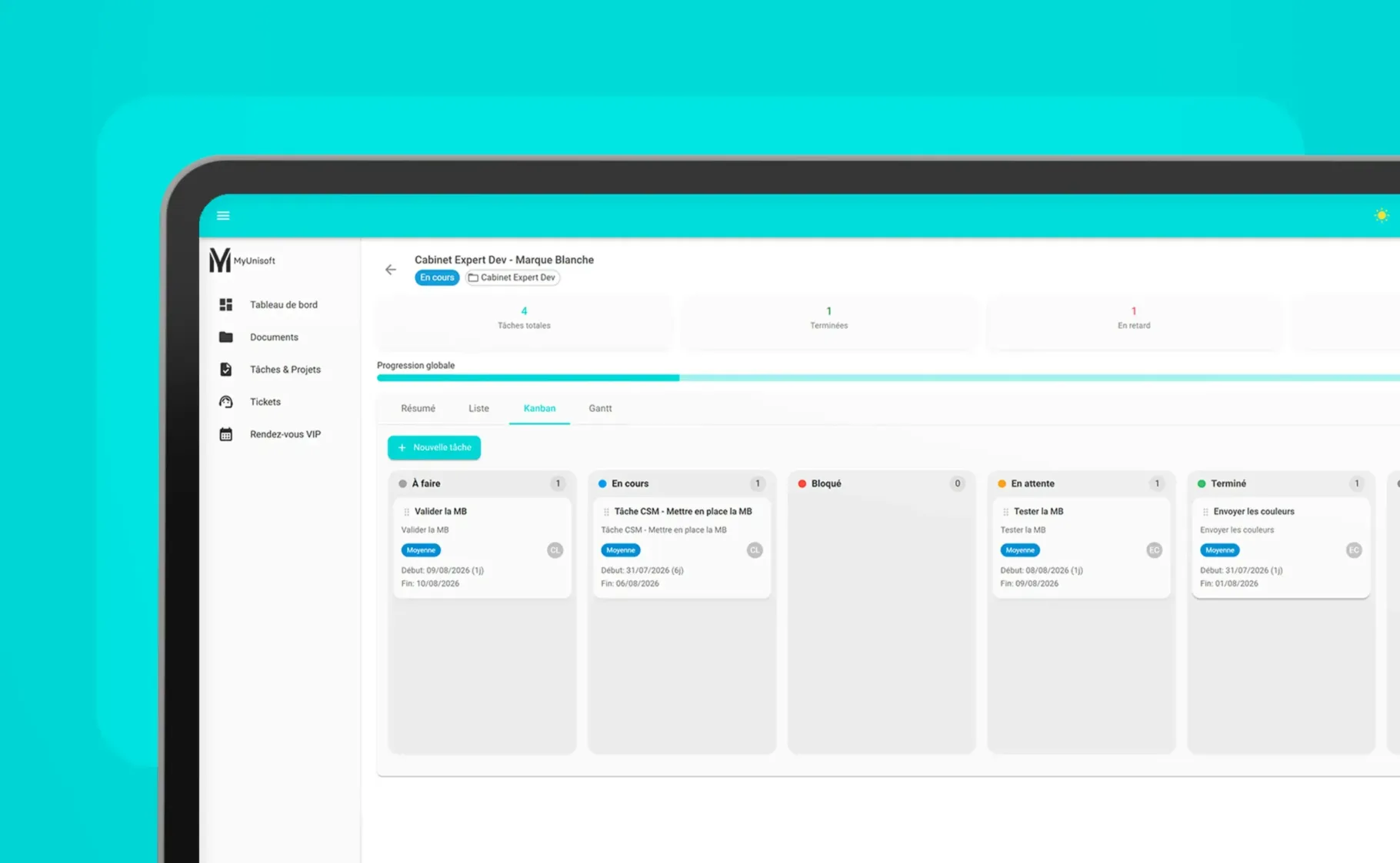 Vue MyU360 pour piloter avec votre CSM MyUnisoft les tâches d’un projet de mise en place